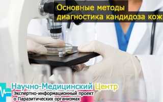 Как избавится от кандидоза на коже