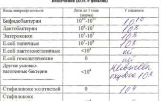 Сколько времени делается анализ на кишечную палочку