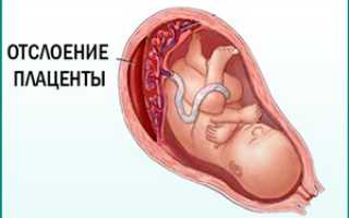 Кишечная палочка в моче 10 в 8 степени при беременности что это