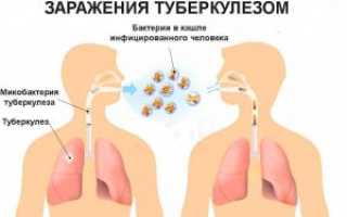 Что делать если на работе есть больной туберкулезом