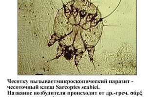 Факторы риска чесотки заражения